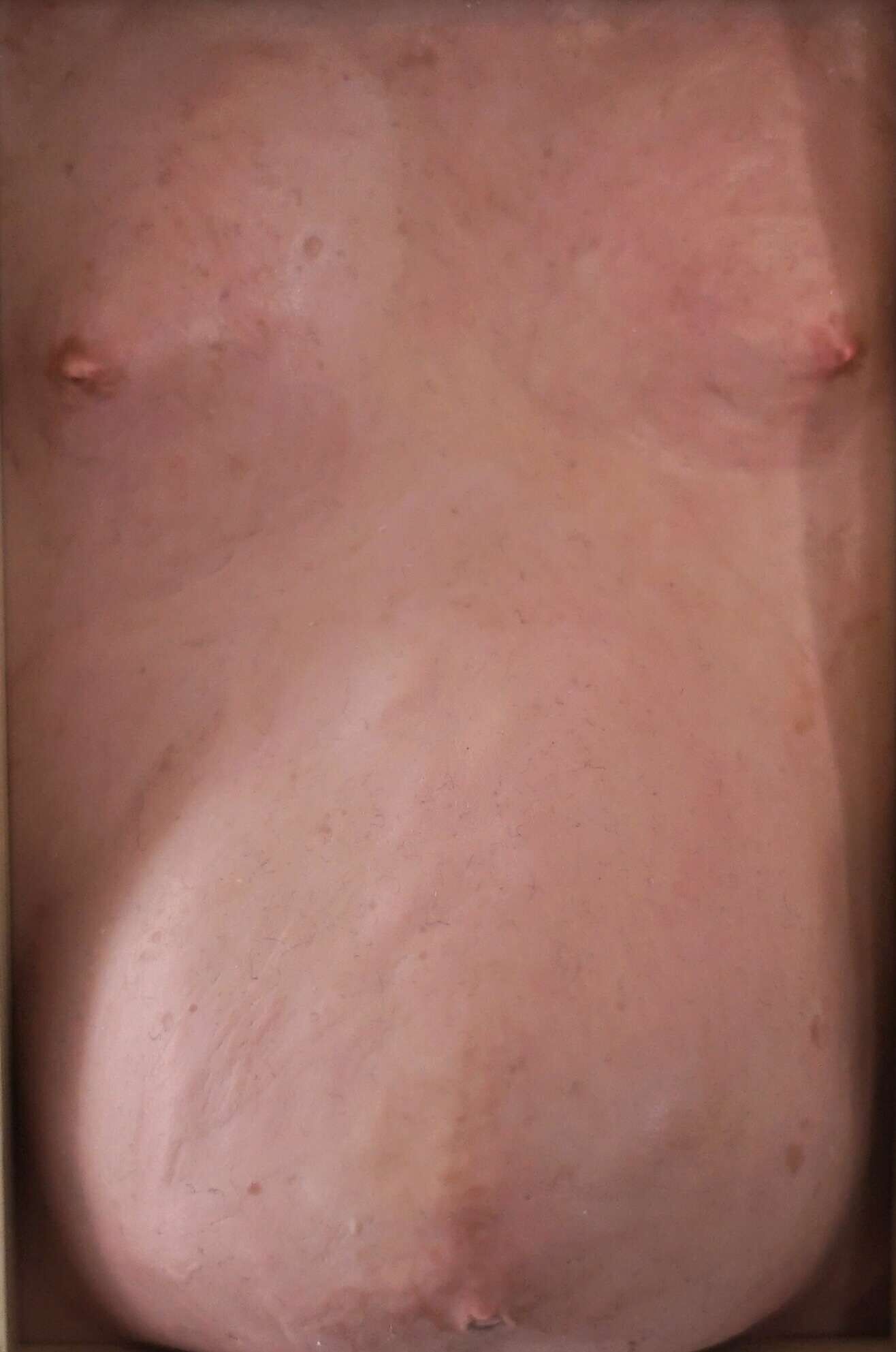 Wohlstandsbauch IX - Azim F. Becker 3