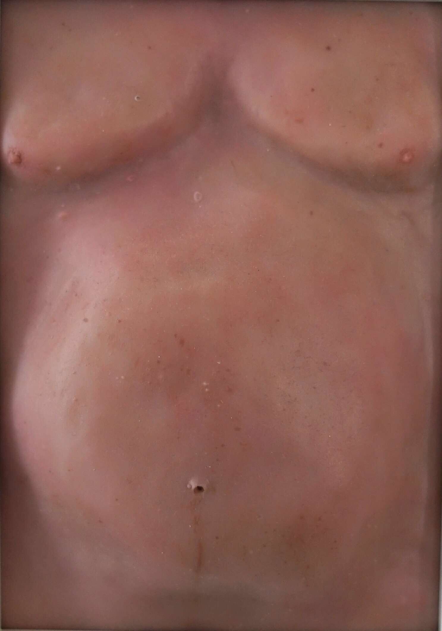 Wohlstandsbauch XI - Azim F. Becker 2