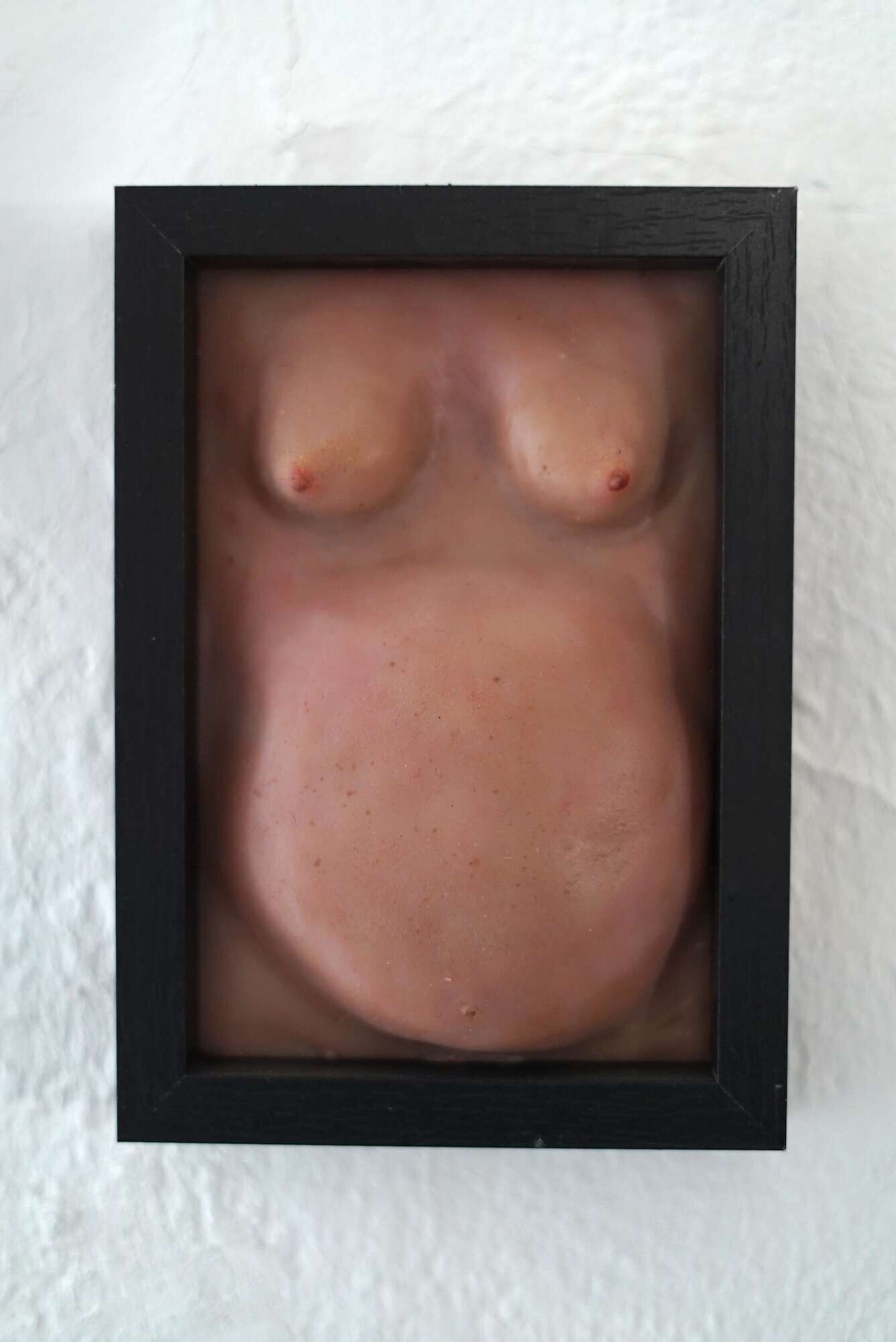 Wohlstandsbauch X - Azim F. Becker 1