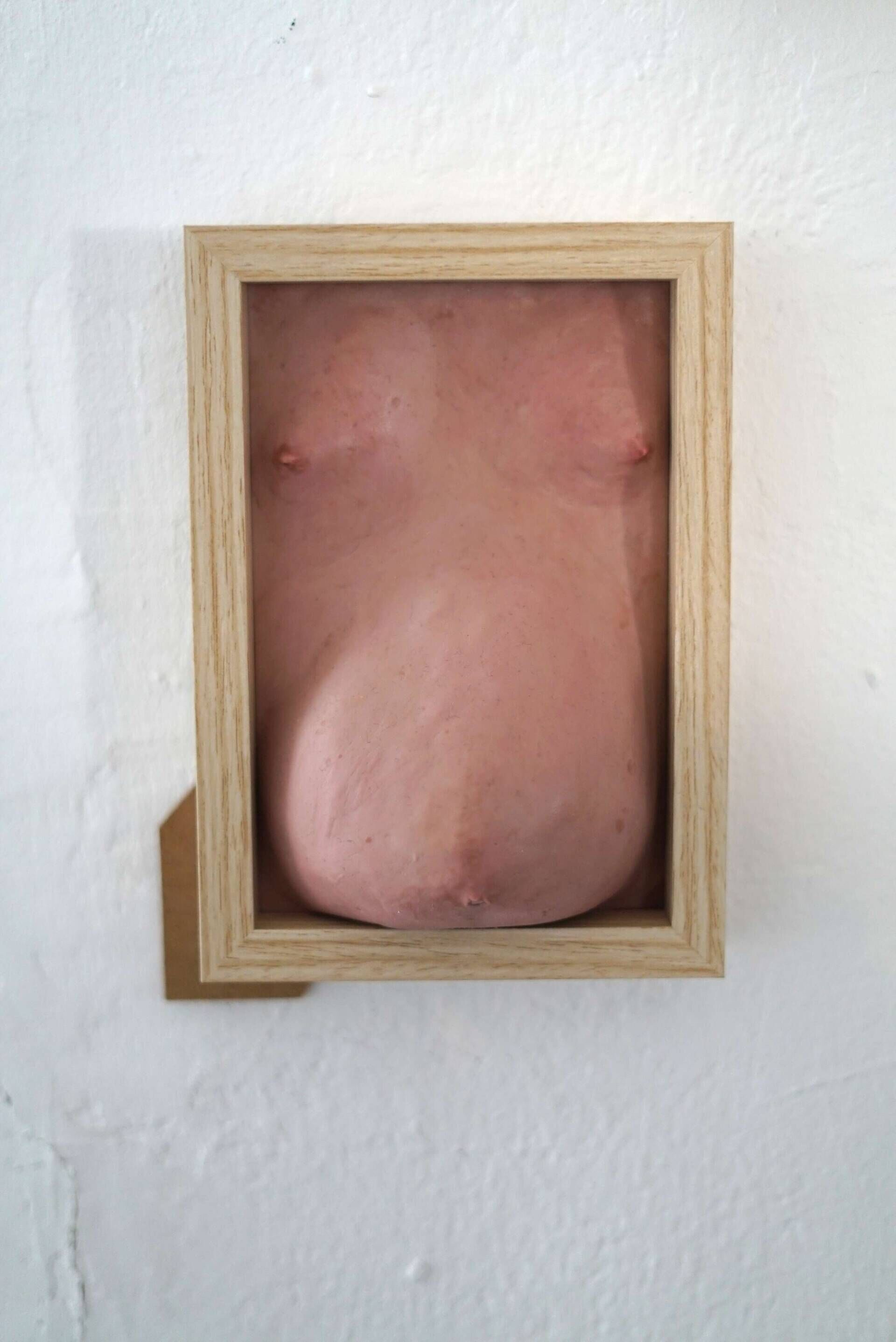 Wohlstandsbauch IX - Azim F. Becker 1