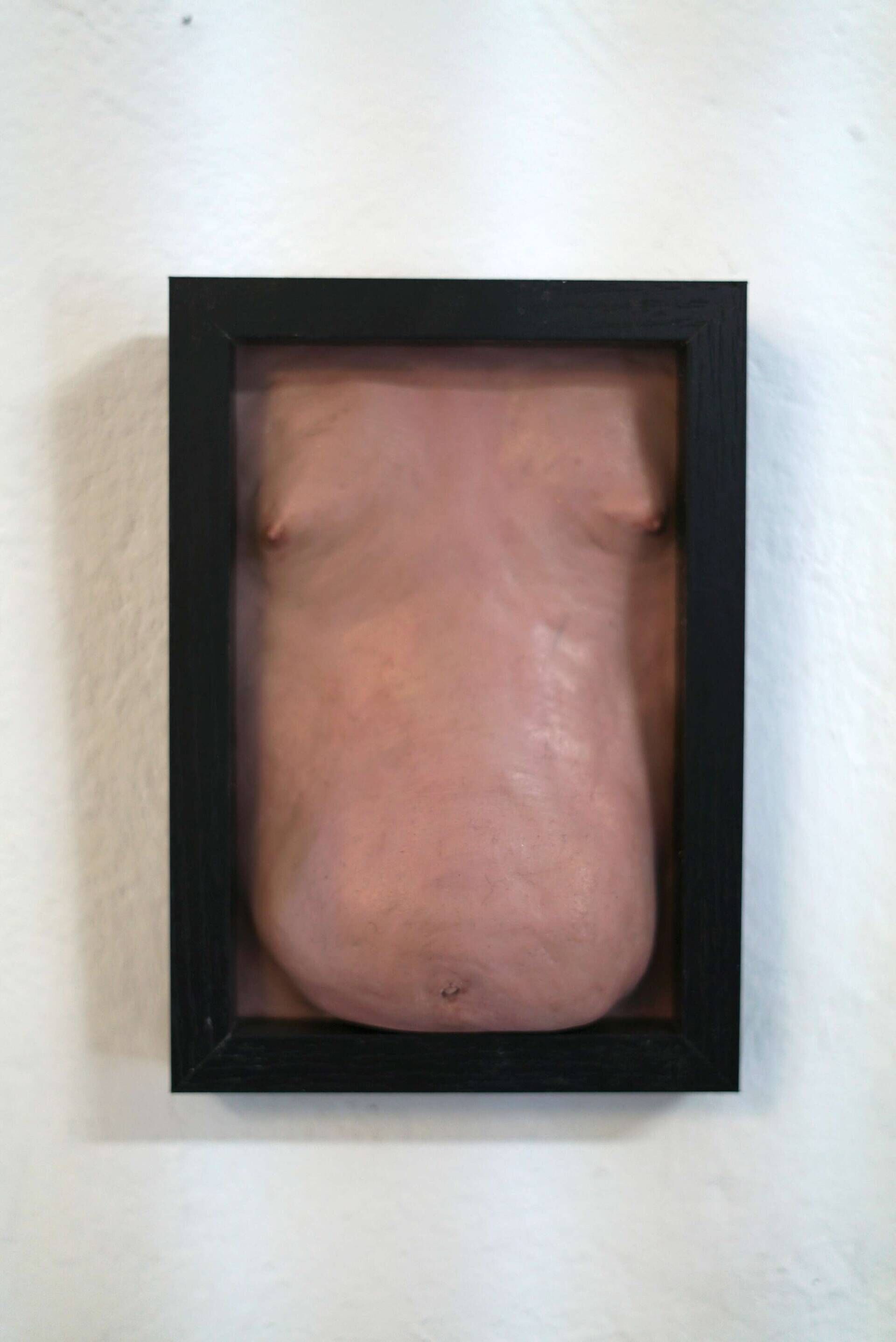 Wohlstandsbauch VII - Azim F. Becker 1