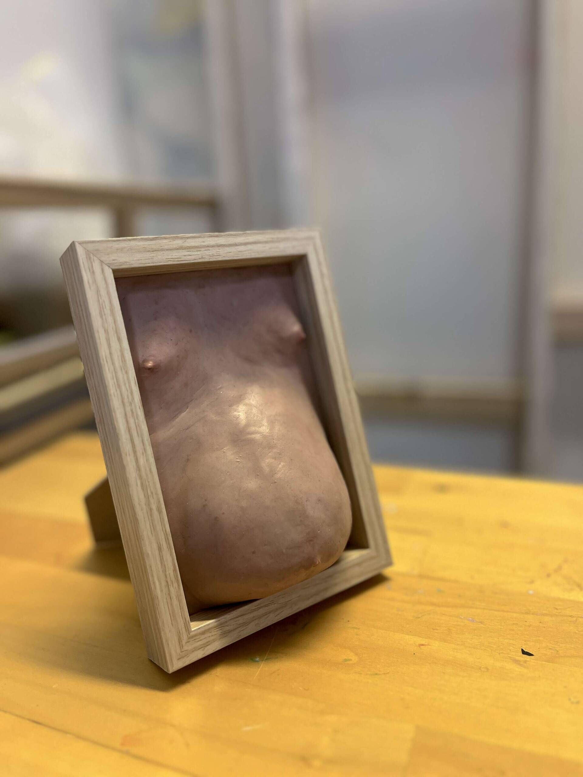 Wohlstandsbauch IX - Azim F. Becker 2