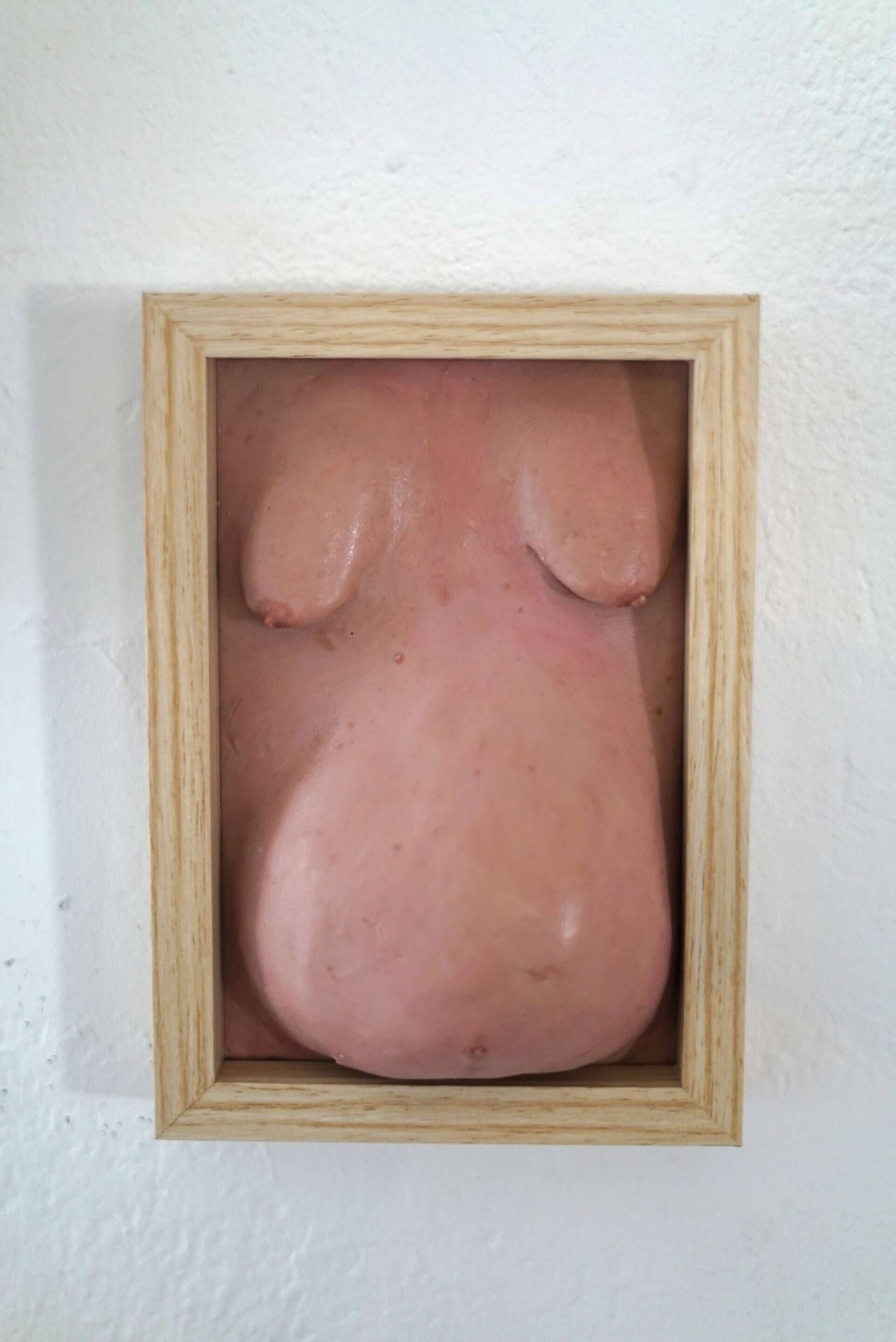 Wohlstandsbauch VIII - Azim F. Becker 1