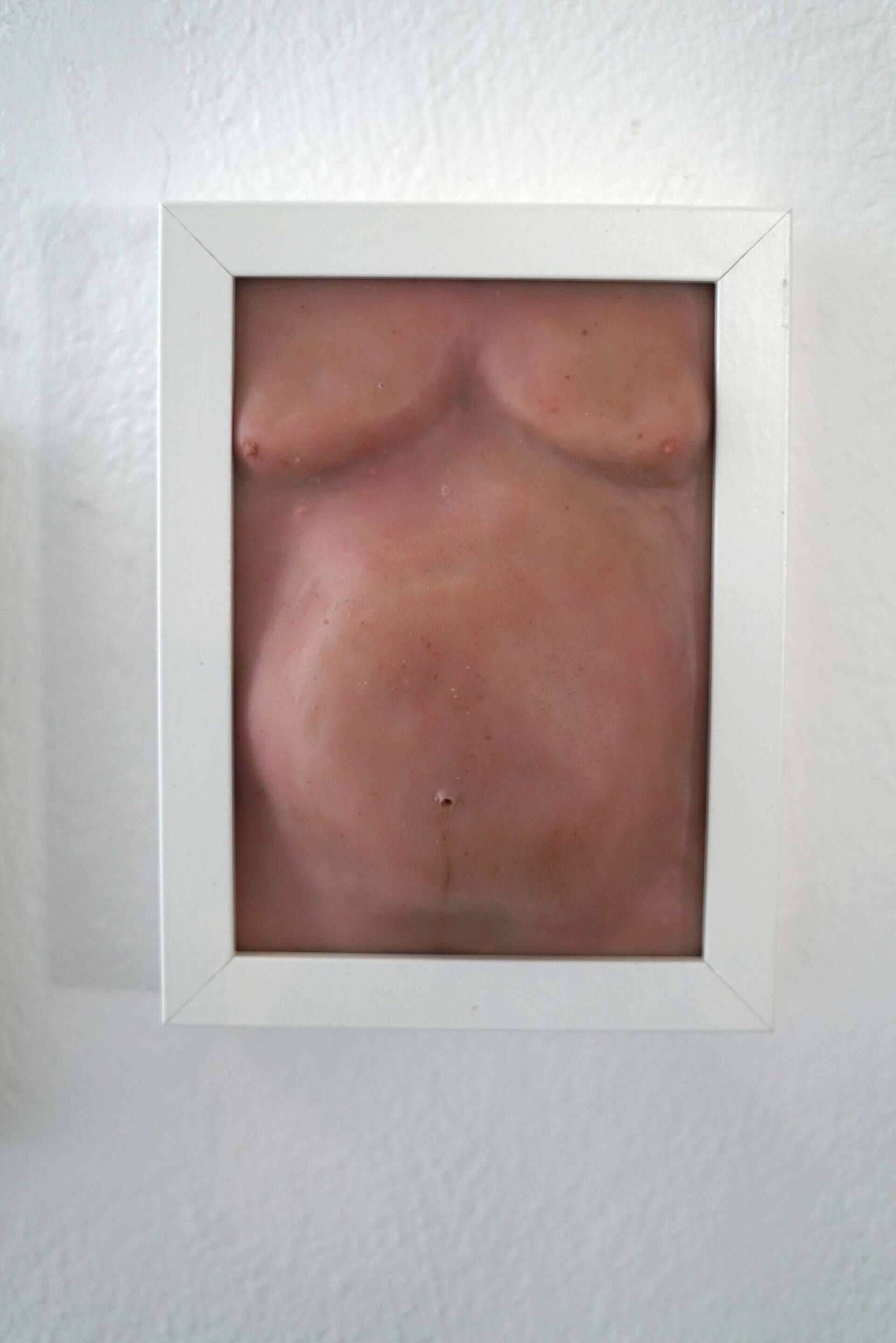 Wohlstandsbauch XI - Azim F. Becker 1