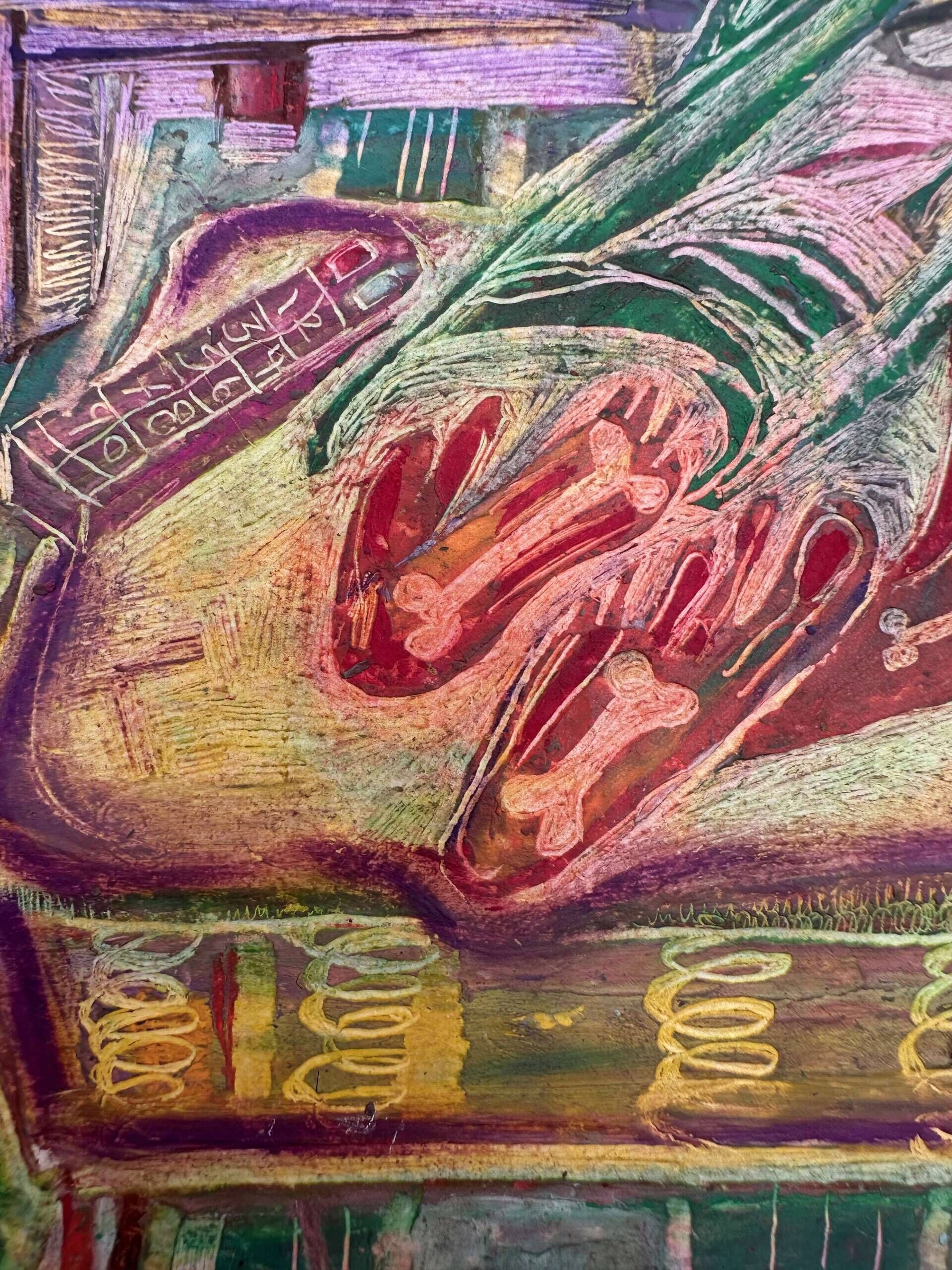 Sofa Syndrom. | Sofa Syndrome. - Žana Vojvodić 3