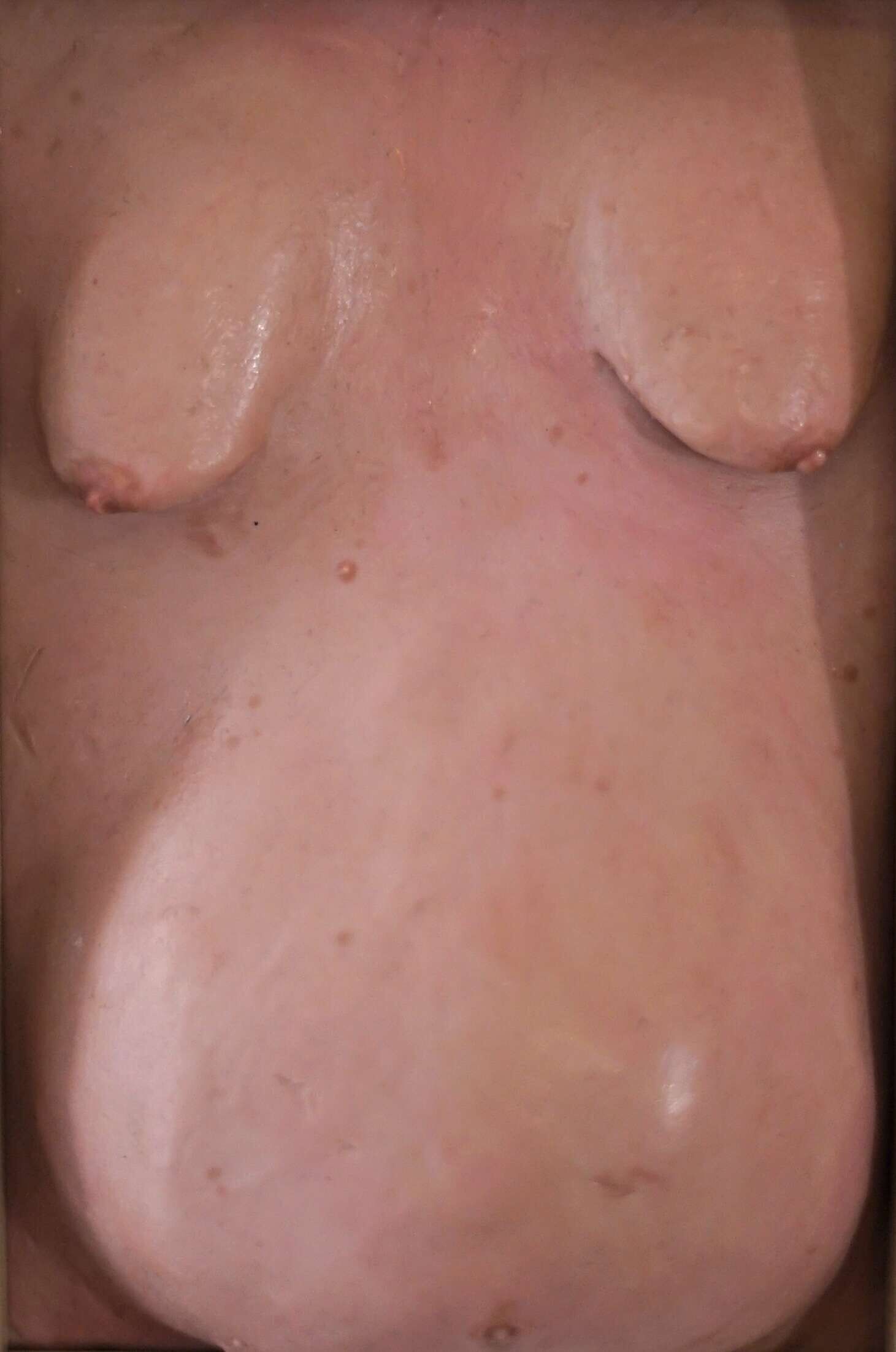 Wohlstandsbauch VIII - Azim F. Becker 2